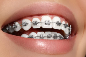 orthodontist 